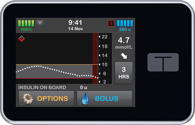 Front-Straight-View -MMOL_CIQ_Home Exercise_v2_CC_4.7 Front-Straight-View -MMOL_CIQ_Home Exercise_v2_CC_4.7